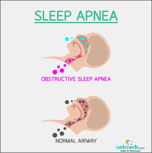 The Different Types Of Sleep Apnea