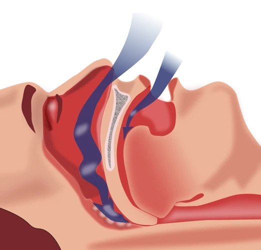 The Science Behind Sleep Apnea