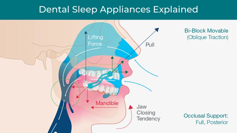 Treatments For Sleep Apnea